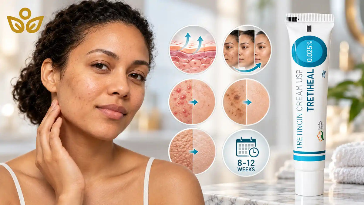 Tretinoin Timeline for Acne, PIH, Melasma and Photoaging
