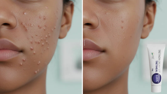 Best Tretinoin Strength for Flat Warts | Clear Skin SA