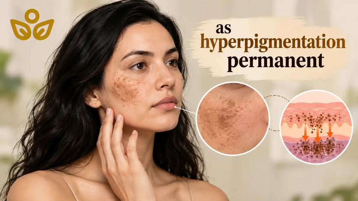 Why Hyperpigmentation Persists: Melanin Depth and Skin Renewal