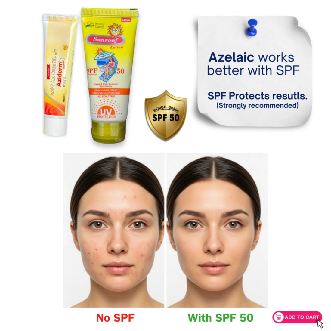 Azelaic acid skincare results comparison with and without SPF 50 sunscreen