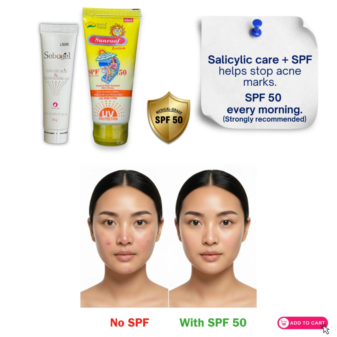 Comparison showing salicylic acid and nicotinamide gel results with SPF 50 sunscreen and without SPF