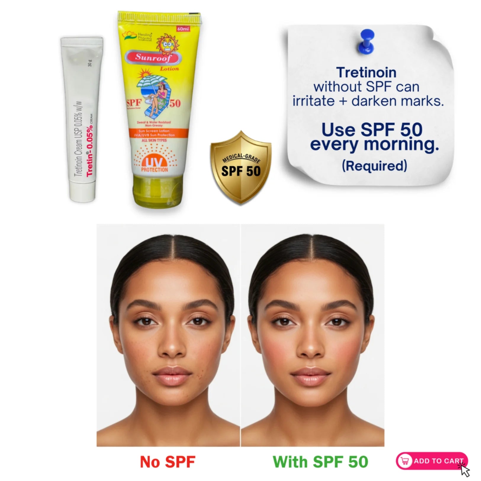 Tretinoin cream 0.05% skincare routine comparison with SPF 50 versus no sunscreen