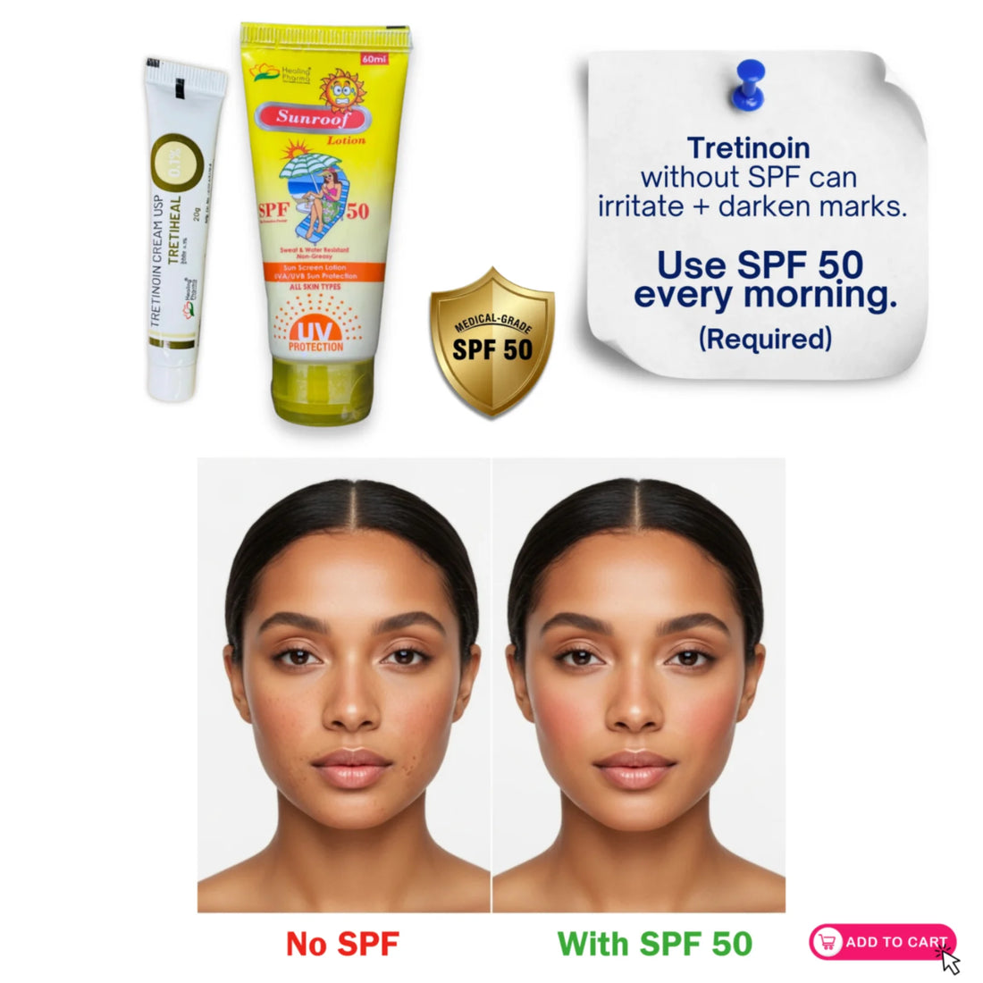 Tretinoin 0.1% skincare results comparison showing skin with SPF 50 and without SPF